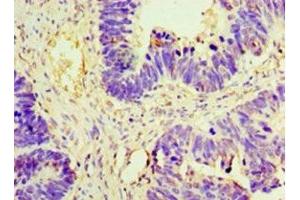 Immunohistochemistry (IHC) image for anti-Anti-Mullerian Hormone (AMH) (AA 26-560) antibody (ABIN7160302)