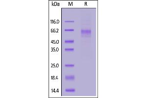 SLC39A6 Protein (AA 29-325) (His tag)