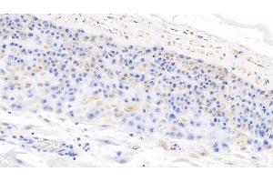 Immunohistochemistry (IHC) image for anti-Pro-Brain Natriuretic Peptide (NT-ProBNP) (NT-ProBNP) (AA 27-102) antibody (ABIN7439867)