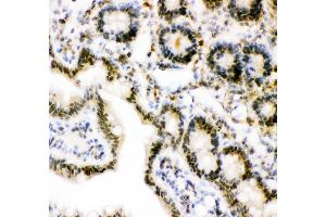 Anti- Ubiquitin Picoband antibody, IHC(P) IHC(P): Rat Intestine Tissue