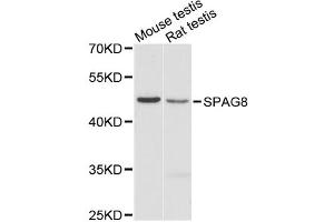 Western blot analysis of extracts of various cell lines, using SPAG8 antibody. (SPAG8 antibody)