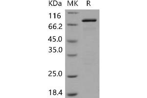 Western Blotting (WB) image for Glutamate Decarboxylase 2 (Pancreatic Islets and Brain, 65kDa) (GAD2) protein (GST tag,His tag) (ABIN7320201) (GAD65 Protein (GST tag,His tag))
