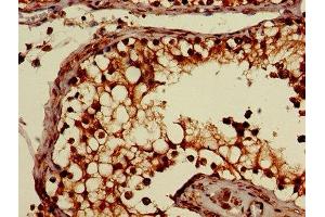 Immunohistochemistry of paraffin-embedded human testis tissue using ABIN7170052 at dilution of 1:100 (ATP1B3 antibody  (AA 57-279))