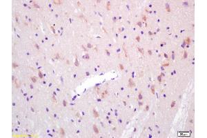 Formalin-fixed and paraffin embedded rat brain labeled with Anti-KAT2B/ GCN5/PCAF Polyclonal Antibody, Unconjugated (ABIN755287) at 1:200 followed by conjugation to the secondary antibody and DAB staining. (KAT2B antibody  (AA 451-550))