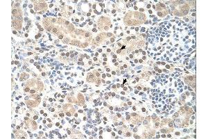 ST8SIA2 antibody was used for immunohistochemistry at a concentration of 4-8 ug/ml. (ST8SIA2 antibody  (C-Term))