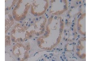 Detection of CRY1 in Human Kidney Tissue using Polyclonal Antibody to Cryptochrome 1 (CRY1) (CRY1 antibody  (AA 3-132))