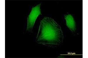 Immunofluorescence of purified MaxPab antibody to LDB3 on HeLa cell. (LIM Domain Binding 3 Protein antibody  (AA 1-283))