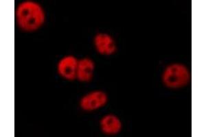 ABIN6277282 staining  HepG2 cells by IF/ICC. (PDCD4 antibody  (N-Term))