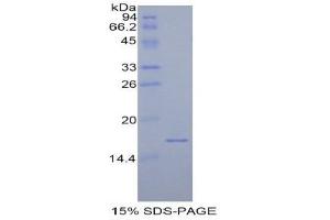 SDS-PAGE (SDS) image for Calcitonin-Related Polypeptide alpha (CALCA) (AA 1-134) protein (His tag) (ABIN2120703)