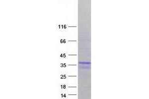 Validation with Western Blot (MBNL3 Protein (Transcript Variant 4) (Myc-DYKDDDDK Tag))