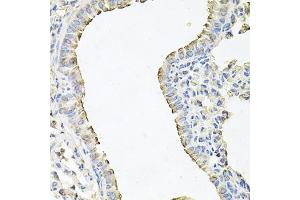 Immunohistochemistry of paraffin-embedded mouse lung using SCNN1G antibody (ABIN6129468, ABIN6147453, ABIN6147454 and ABIN6221724) at dilution of 1:100 (40x lens). (SCNN1G antibody  (AA 85-355))