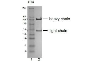 SDS-PAGE analysis of purified QV-6A8-S3 monoclonal antibody. (CD81 antibody)