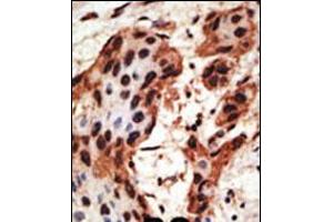 GJB6 antibody  (N-Term)