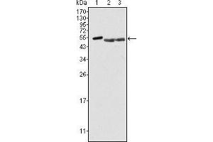 Western blot analysis using PTK6 mouse mAb against Hela (1), A549 (2) and MCF-7 (3) cell lysate. (PTK6 antibody)
