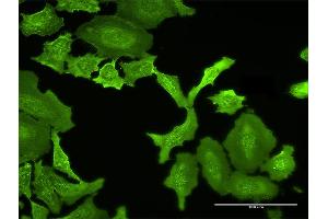 Immunofluorescence of purified MaxPab antibody to MPP5 on HeLa cell. (MPP5 antibody  (AA 1-675))