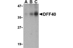 Western blot analysis of DFF40 in Jurkat cell lysate with AP30288PU-N DFF40 antibody at (A) 0.