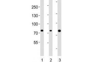 Western blot analysis of lysate from human 1) ovary, 2) placenta and 3) plasma lysate using Integrin beta 8 antibody diluted at 1:1000. (ITGB8 antibody  (AA 197-231))