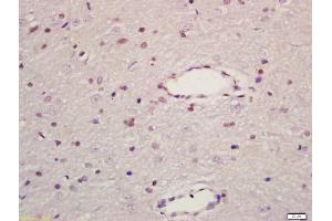 Formalin-fixed and paraffin embedded rat brain labeled with Anti-MAPK8IP1 Polyclonal Antibody, Unconjugated (ABIN716441) at 1:200 followed by conjugation to the secondary antibody and DAB staining (MAPK8IP1 antibody  (AA 425-524))