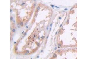 Immunohistochemistry (IHC) image for anti-Cell Division Cycle 25 Homolog B (S. Pombe) (CDC25B) (AA 377-566) antibody (ABIN1171796)