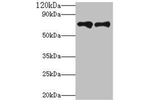 Western blot All lanes: Klkb1 antibody at 2 μg/mL Lane 1: Hela whole cell lysate Lane 2: Rat brain tissue Secondary Goat polyclonal to rabbit IgG at 1/10000 dilution Predicted band size: 72 kDa Observed band size: 72 kDa (KLKB1 antibody  (AA 391-638))