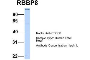 Host:  Rabbit  Target Name:  RBBP8  Sample Type:  Human Fetal Heart  Antibody Dilution:  1. (Retinoblastoma Binding Protein 8 antibody  (C-Term))