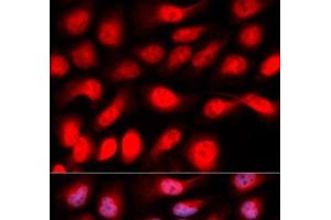 Immunofluorescence analysis of U2OS cells using ZEB1 Polyclonal Antibody (ZEB1 antibody)