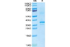 RANKL Protein (AA 70-316) (His tag)