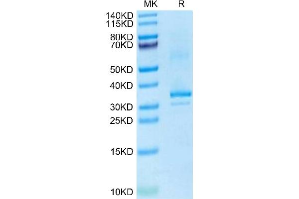 RANKL Protein (AA 70-316) (His tag)