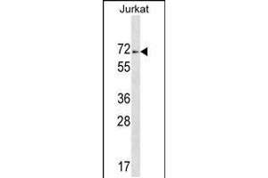 Western blot analysis in Jurkat cell line lysates (35ug/lane). (ZNF613 antibody  (C-Term))