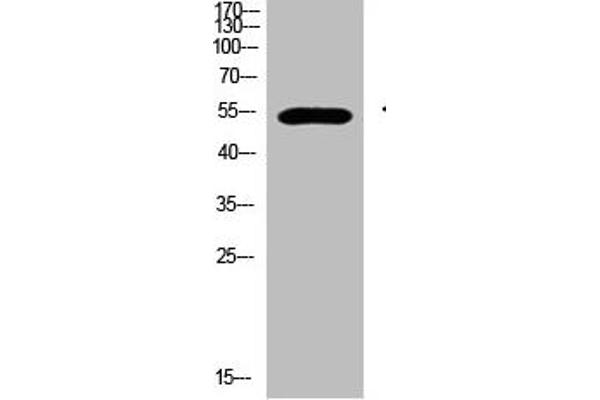 GCM2 抗体  (AA 21-70)