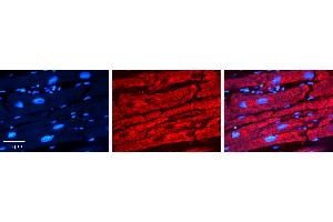 Rabbit Anti-CTBP1 Antibody   Formalin Fixed Paraffin Embedded Tissue: Human heart Tissue Observed Staining: Cytoplasmic Primary Antibody Concentration: N/A Other Working Concentrations: 1:600 Secondary Antibody: Donkey anti-Rabbit-Cy3 Secondary Antibody Concentration: 1:200 Magnification: 20X Exposure Time: 0. (CTBP1 antibody  (N-Term))