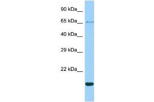 Host: Rabbit Target Name: CR1L Sample Type: ACHN Whole cell lysates Antibody Dilution: 1. (CR1L antibody  (N-Term))