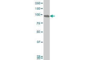 DDX54 monoclonal antibody (M03), clone 5B3 Western Blot analysis of DDX54 expression in A-431 . (DDX54 antibody  (AA 778-881))