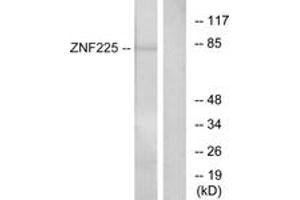 Western blot analysis of extracts from HeLa cells, using ZNF225 Antibody. (ZNF225 antibody  (AA 641-690))