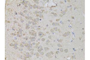 Immunohistochemistry of paraffin-embedded rat brain using PEA15 antibody (ABIN6003664) at dilution of 1/100 (40x lens).