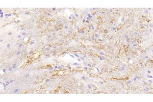 Detection of CTSG in Mouse Spinal cord Tissue using Polyclonal Antibody to Cathepsin G (CTSG) (Cathepsin G antibody  (AA 21-261))