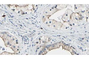 ABIN6277728 at 1/100 staining Human prostate tissue by IHC-P. (DVL1 antibody)