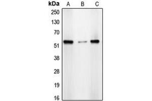 Western blot analysis of CDYL2 expression in A431 (A), HepG2 (B), HeLa (C) whole cell lysates. (CDYL2 antibody  (N-Term))