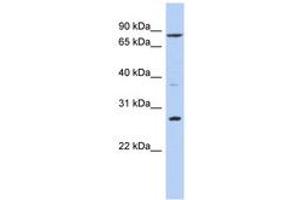 Image no. 1 for anti-Kruppel-Like Factor 12 (KLF12) (AA 51-100) antibody (ABIN6742325) (KLF12 antibody  (AA 51-100))