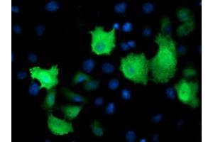 Anti-TMOD1 mouse monoclonal antibody (ABIN2454776) immunofluorescent staining of COS7 cells transiently transfected by pCMV6-ENTRY TMOD1 (RC201134). (Tropomodulin 1 antibody)