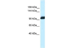 WB Suggested Anti-Zhx1 Antibody   Titration: 1. (ZHX1 antibody  (C-Term))