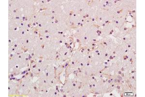 Formalin-fixed and paraffin embedded rat brain labeled with Anti-Glypican 6 Polyclonal Antibody, Unconjugated (ABIN678368) at 1:200 followed by conjugation to the secondary antibody and DAB staining (Glypican 6 antibody  (AA 351-450))
