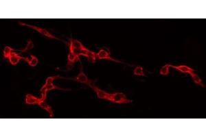 ABIN6266554 staining LOVO by IF/ICC. (SLC2A3 antibody  (C-Term))