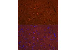 Immunofluorescence analysis of Mouse brain using DC/DCLK1 antibody (ABIN6134321, ABIN6139438 and ABIN7101849) at dilution of 1:100 (40x lens). (DCLK1 antibody)