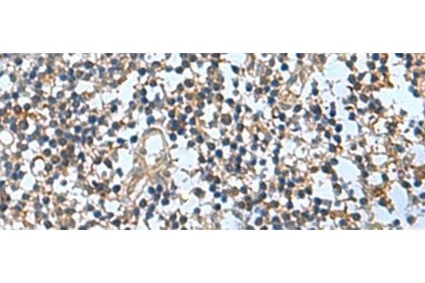 TRO antibody