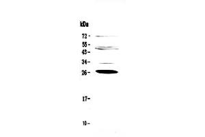 Western blot analysis of Factor D using anti-Factor D antibody . (Adipsin antibody  (AA 26-253))
