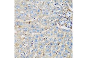 Immunohistochemistry of paraffin-embedded rat liver using PROCR antibody. (PROCR antibody  (AA 19-209))