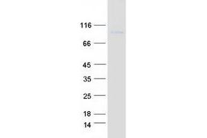 Validation with Western Blot