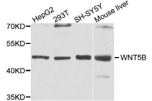 Western blot analysis of extracts of various cell lines, using WNT5B antibody. (WNT5B antibody  (AA 120-359))