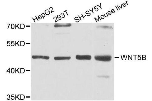 WNT5B antibody  (AA 120-359)